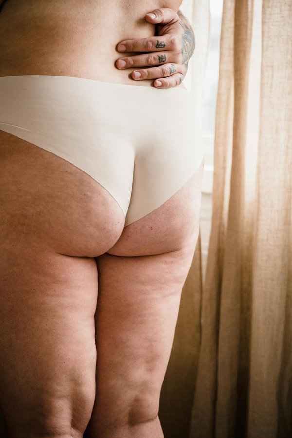 Les meilleures solutions pour soulager l'irritation anale